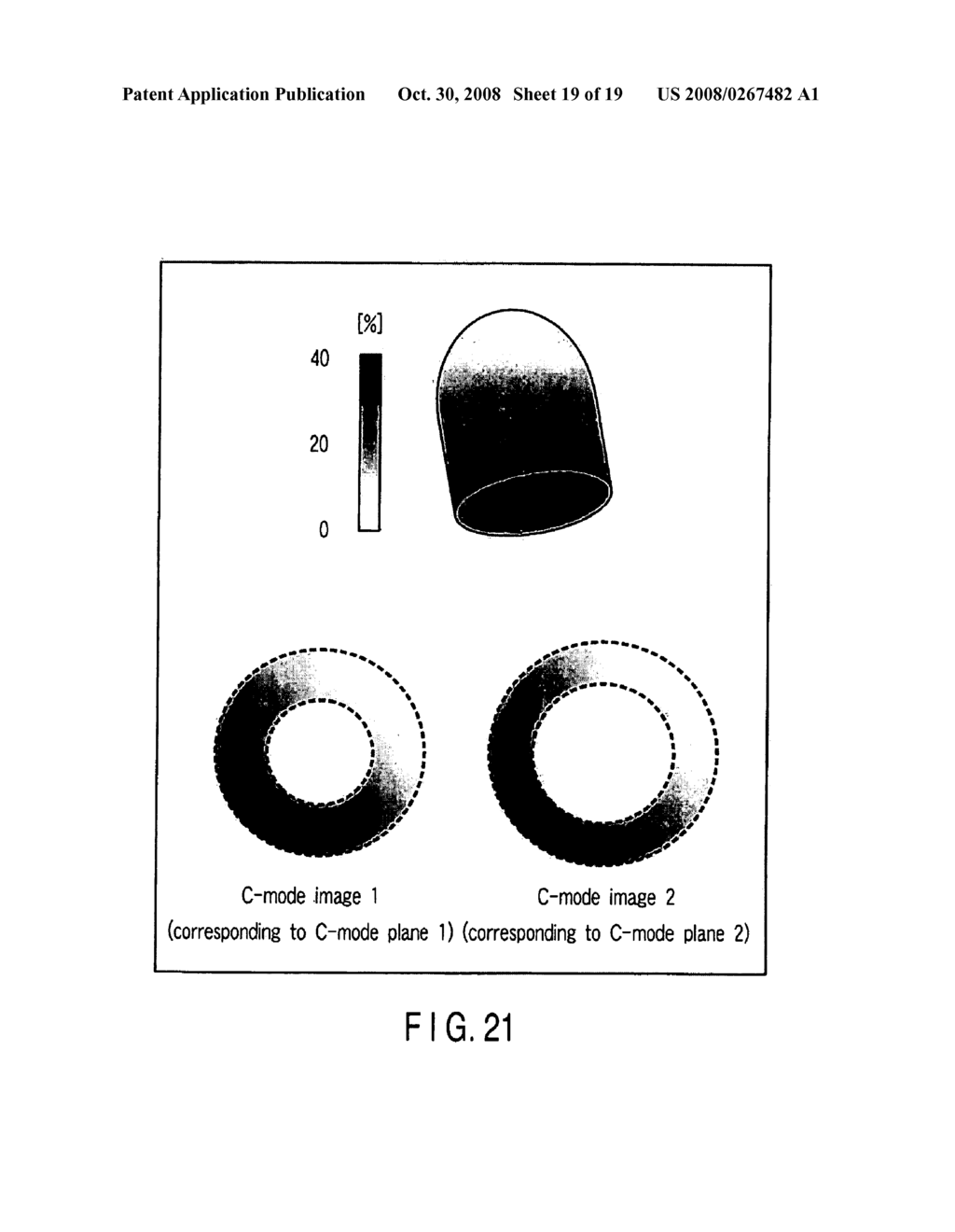 ULTRASONIC IMAGE PROCESSING APPARATUS AND ULTRASONIC IMAGE PROCESSING METHOD - diagram, schematic, and image 20