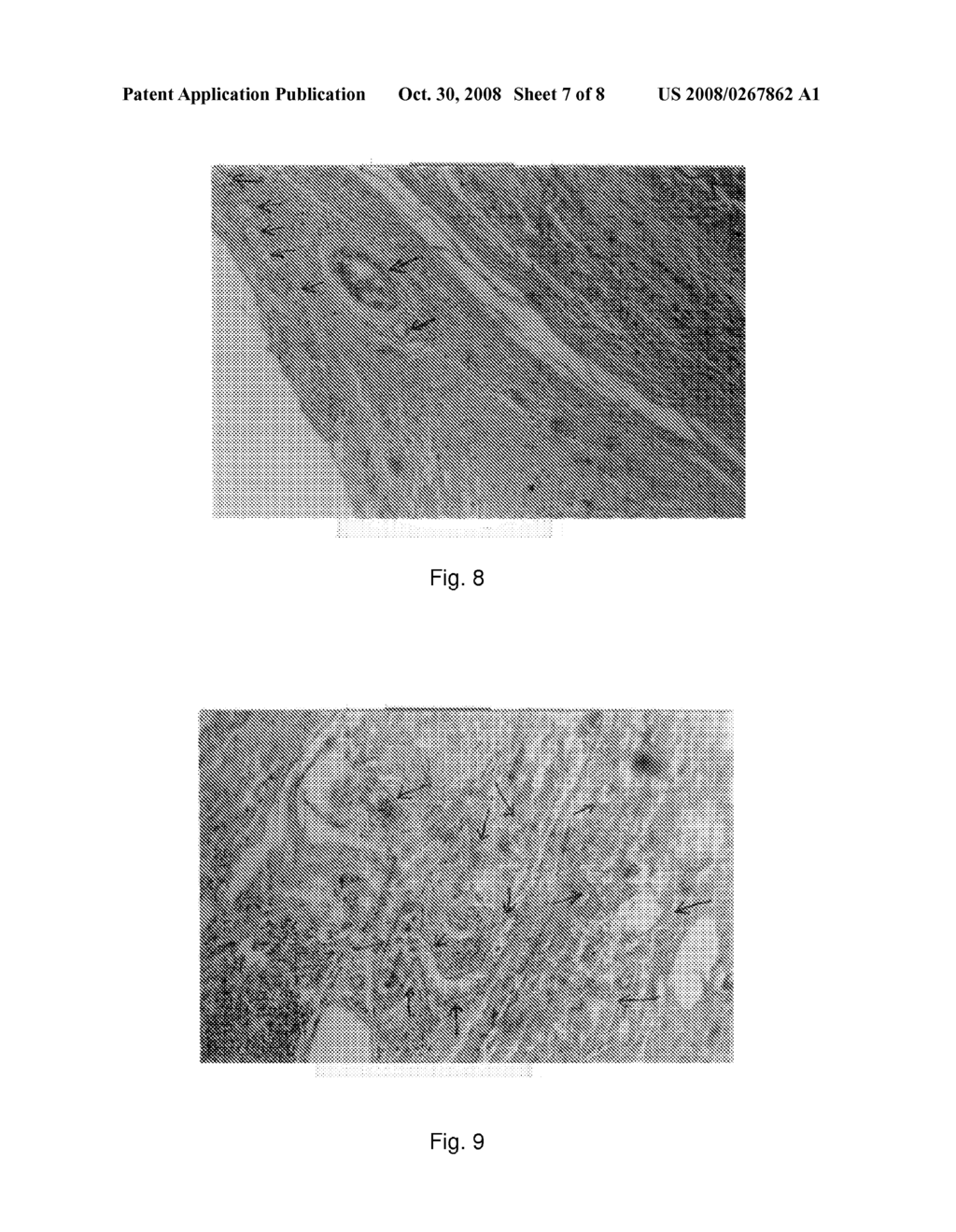 METHOD OF TREATING CANCER - diagram, schematic, and image 08