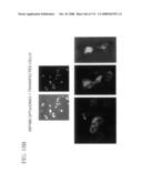 Nucleic acid and corresponding protein entitled 98P4B6 useful in treatment and detection of cancer diagram and image