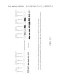 Nucleic acid and corresponding protein entitled 98P4B6 useful in treatment and detection of cancer diagram and image