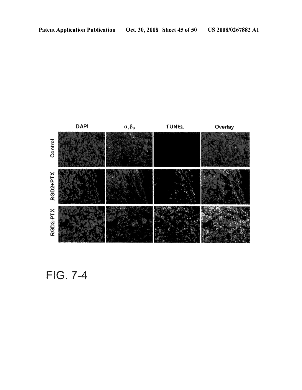 Imaging compounds, methods of making imaging compounds, methods of imaging, therapeutic compounds, methods of making therapeutic compounds, and methods of therapy - diagram, schematic, and image 46