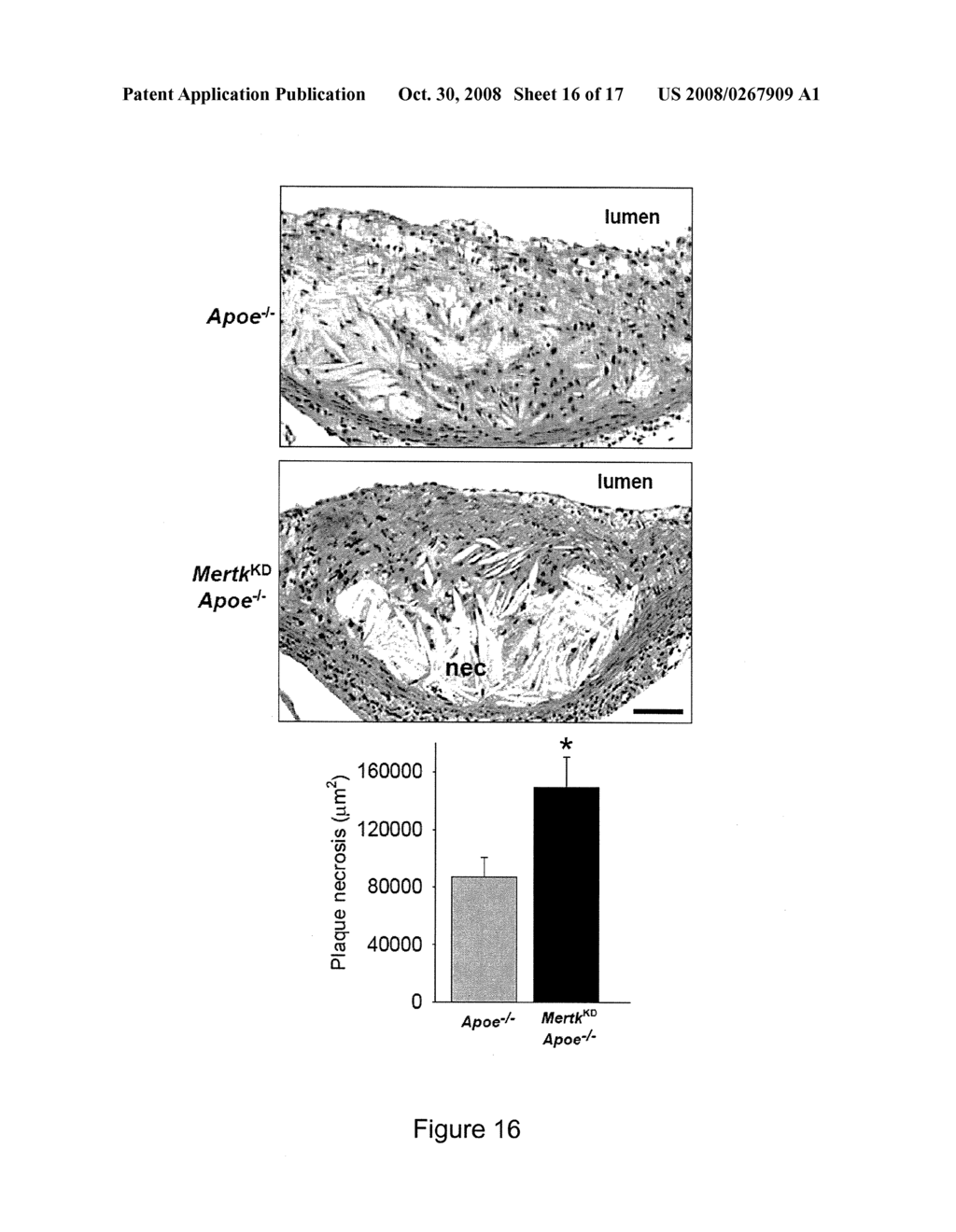 PHAGOCYTE ENHANCEMENT THERAPY FOR ATHEROSCLEROSIS - diagram, schematic, and image 17