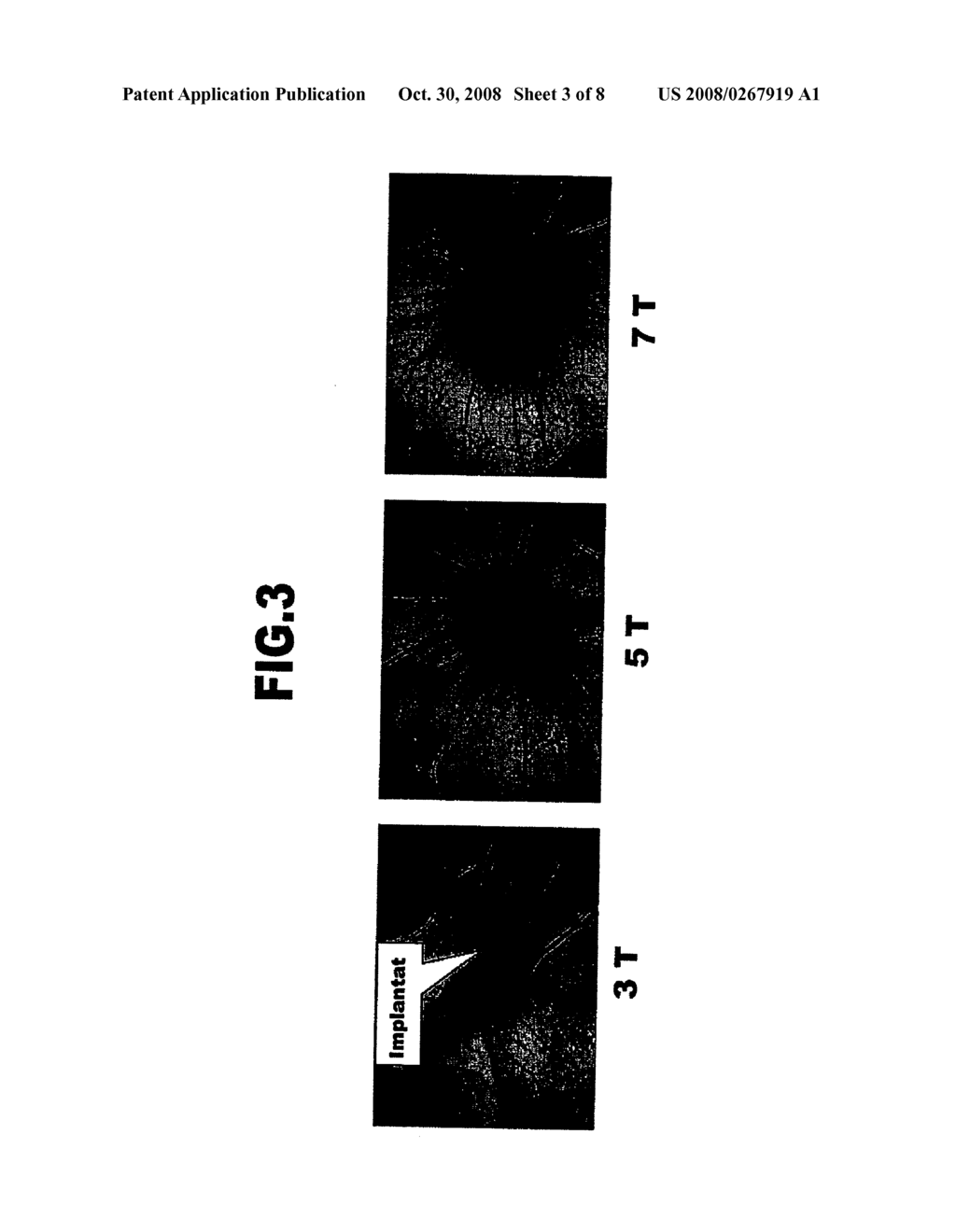 ANGIOGENESIS-PROMOTING SUBSTRATE - diagram, schematic, and image 04