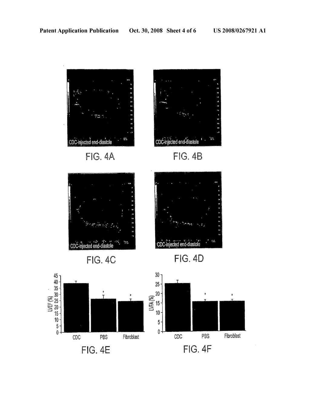 Cardiac Stem Cells - diagram, schematic, and image 05