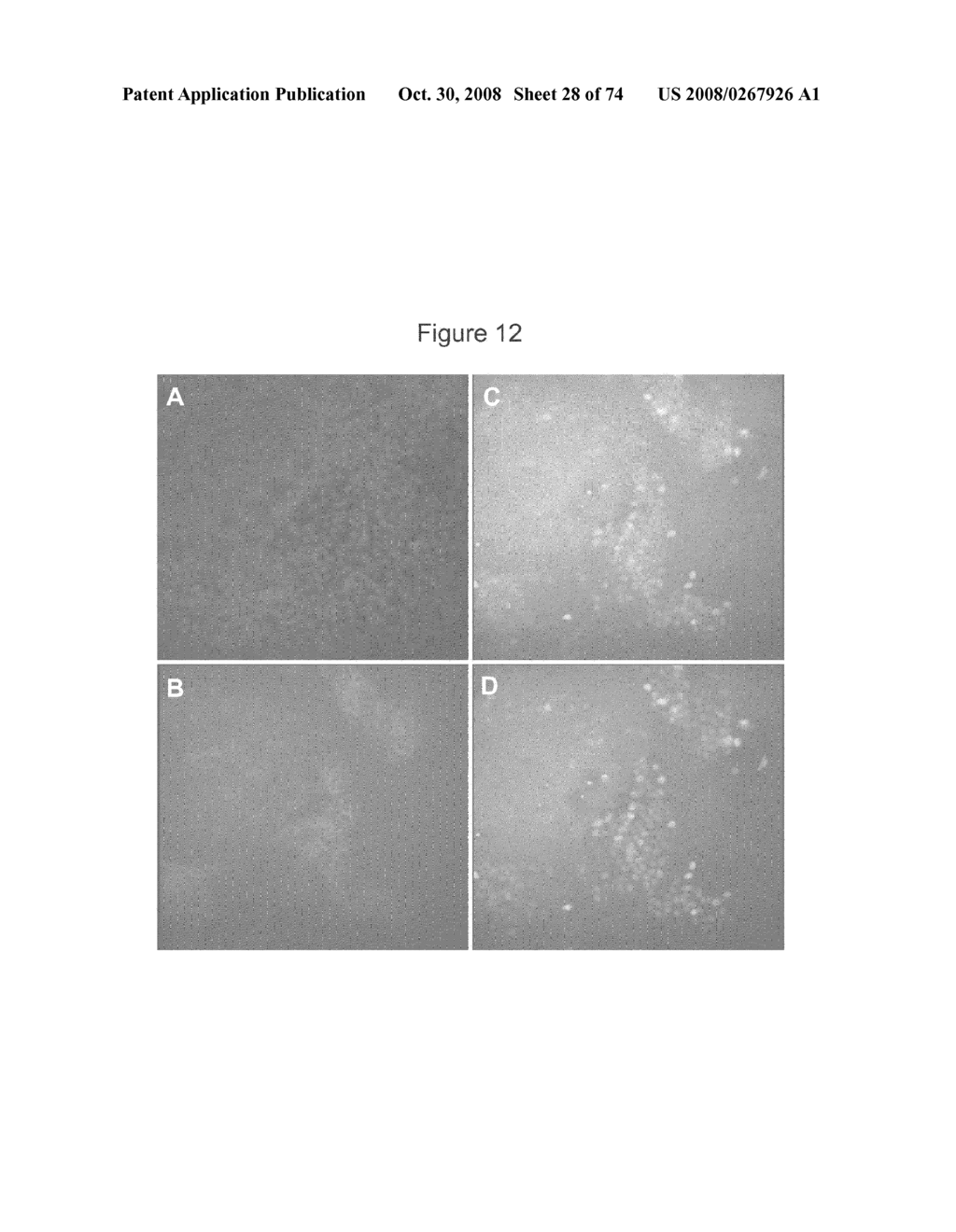 METHODS OF PRODUCING PANCREATIC HORMONES - diagram, schematic, and image 29