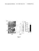 Anti-angiogenic targets for cancer therapy diagram and image