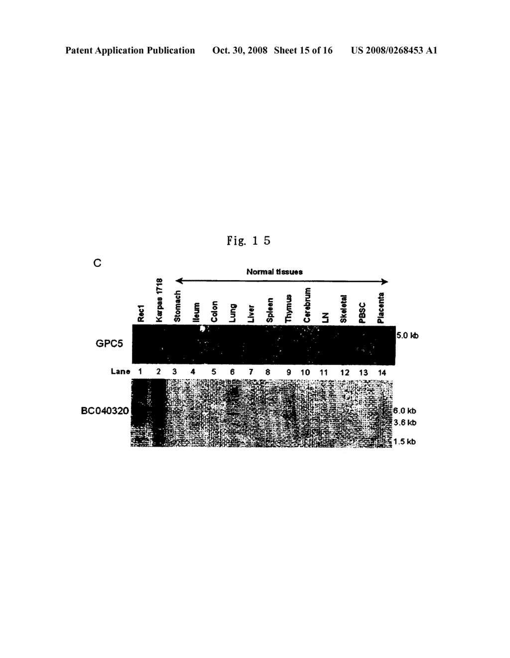 Types of lymphoma and method for prognosis thereof - diagram, schematic, and image 16