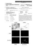 Methods and Compositions Involving A1c Subunit of L-Type Calcium Channels in Smooth Muscle Cells diagram and image