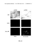 Methods and Compositions Involving A1c Subunit of L-Type Calcium Channels in Smooth Muscle Cells diagram and image