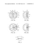 STEERABLE LESION EXCLUDING HEART IMPLANTS FOR CONGESTIVE HEART FAILURE diagram and image