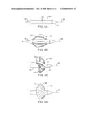 STEERABLE LESION EXCLUDING HEART IMPLANTS FOR CONGESTIVE HEART FAILURE diagram and image