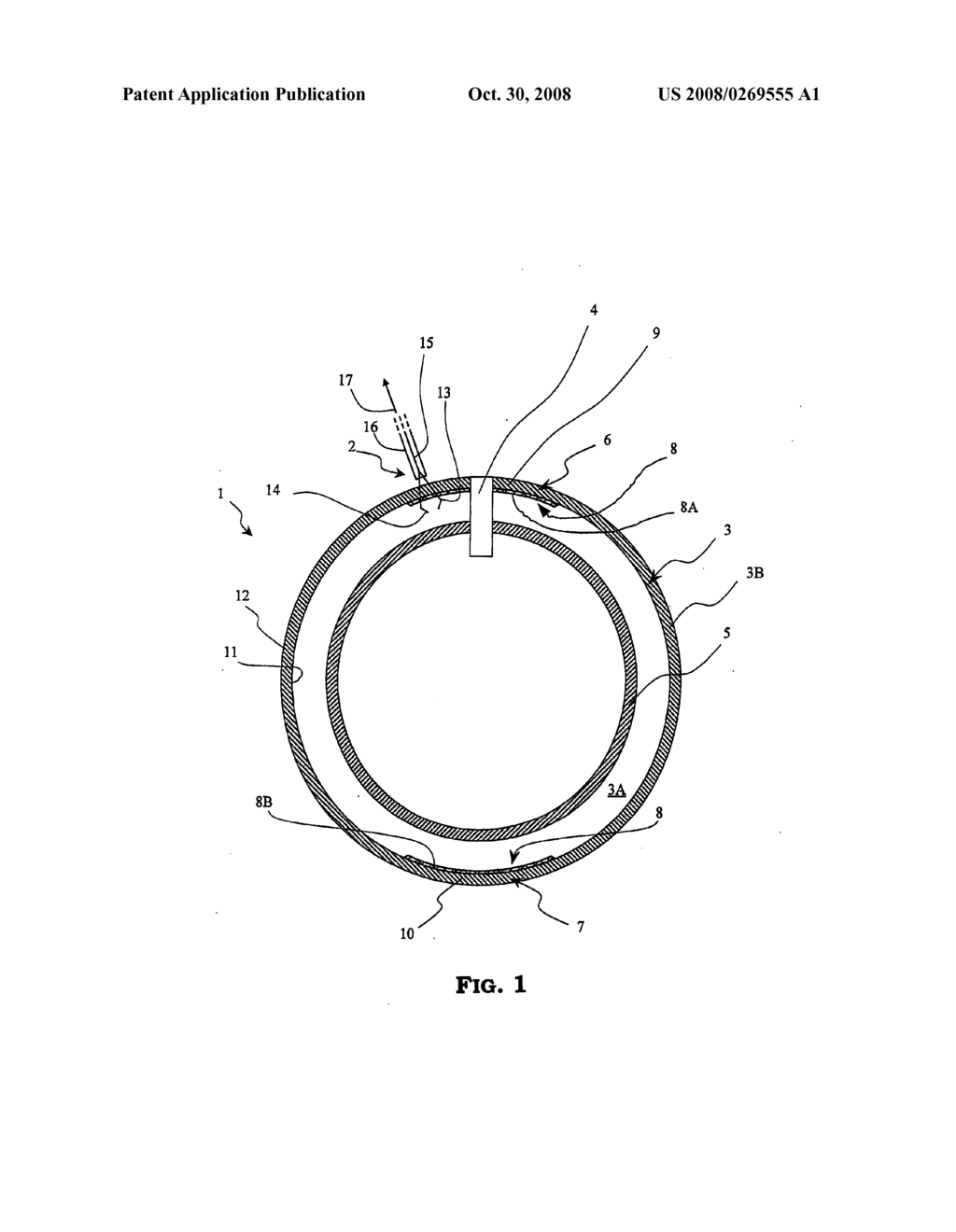 Intragastric Balloon With Extraction Reinforcement - diagram, schematic, and image 02