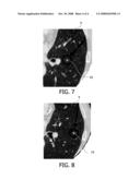 Identifying Abnormal Tissue in Images of Computed Tomography diagram and image