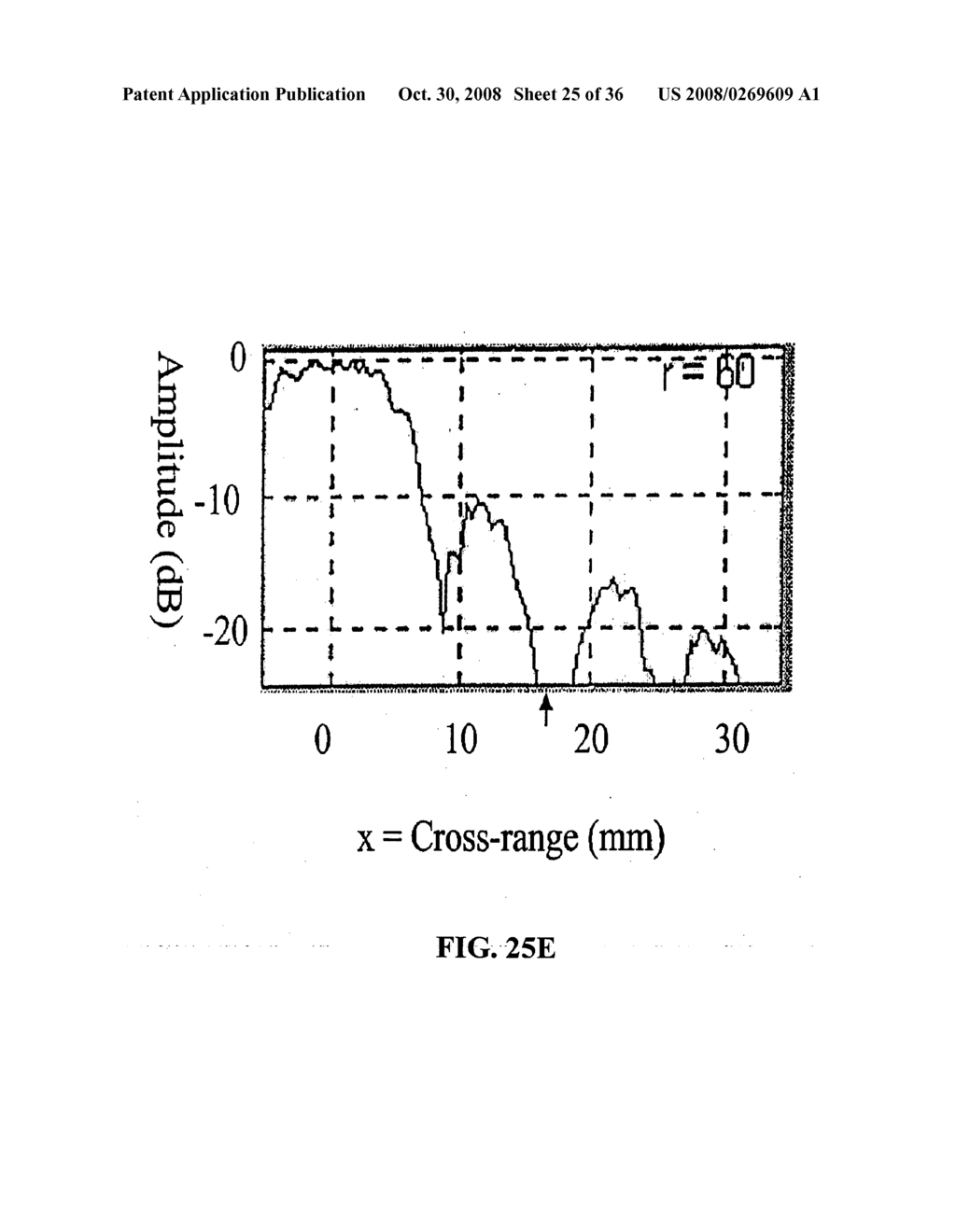 DEVICES AND METHODS FOR TRACKING BLOOD FLOW AND DETERMINING PARAMETERS OF BLOOD FLOW - diagram, schematic, and image 26