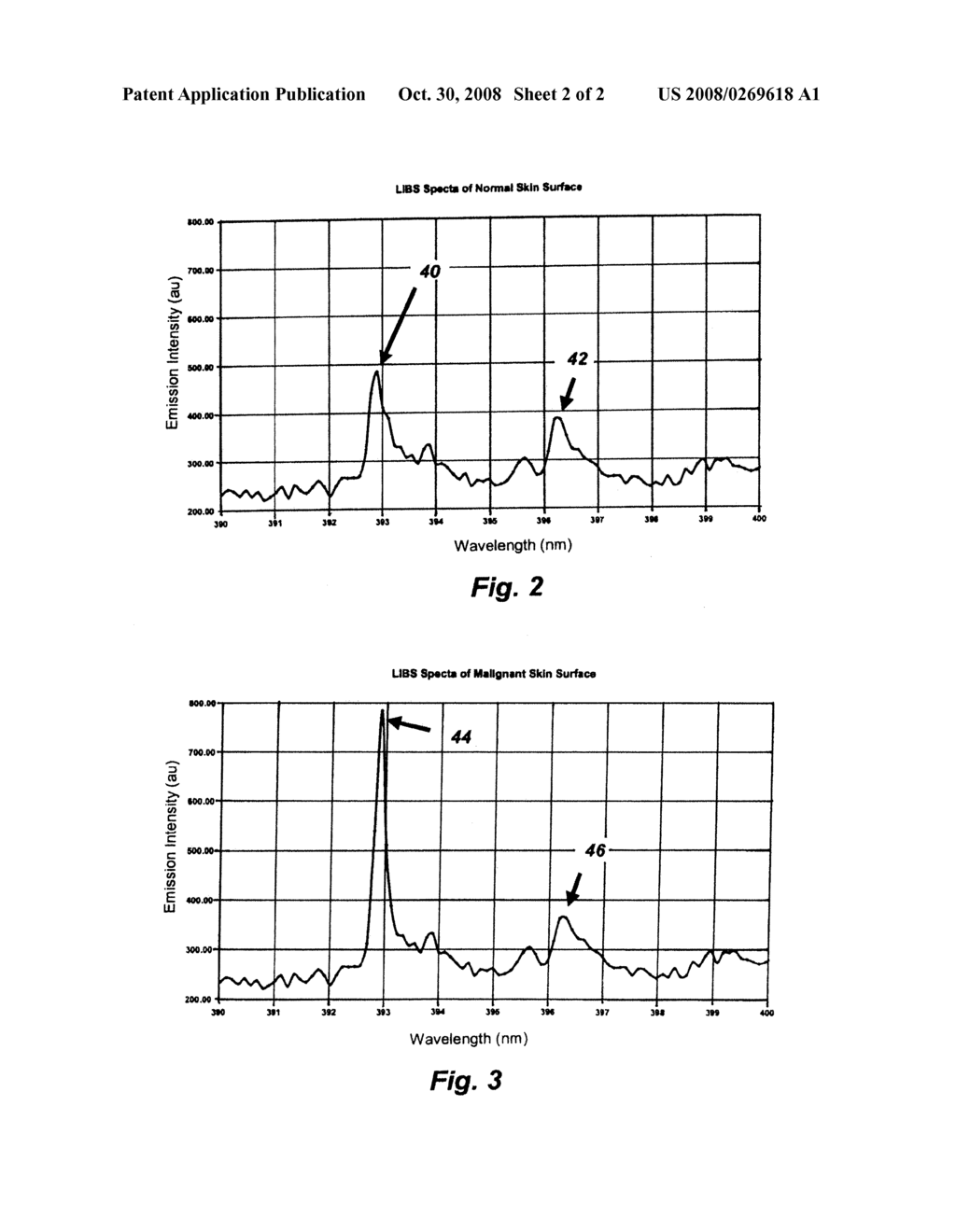 Non-Invasive In-Situ Detection Of Malignant Skin Tissue And Other Abnormalities Using Laser Plasma Spectroscopy - diagram, schematic, and image 03