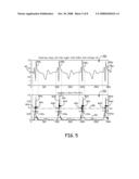 MORPHOLOGY BASED ARRHYTHMIA DETECTION diagram and image