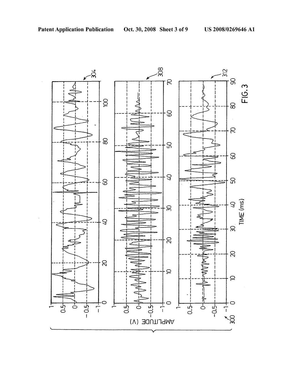 System and Method for Detecting Swallowing Activity - diagram, schematic, and image 04