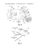 System and Method For Controlling Traversal of an Igested Capsule diagram and image