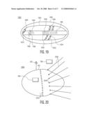 System and Method For Controlling Traversal of an Igested Capsule diagram and image