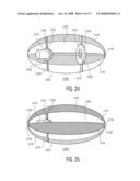 System and Method For Controlling Traversal of an Igested Capsule diagram and image