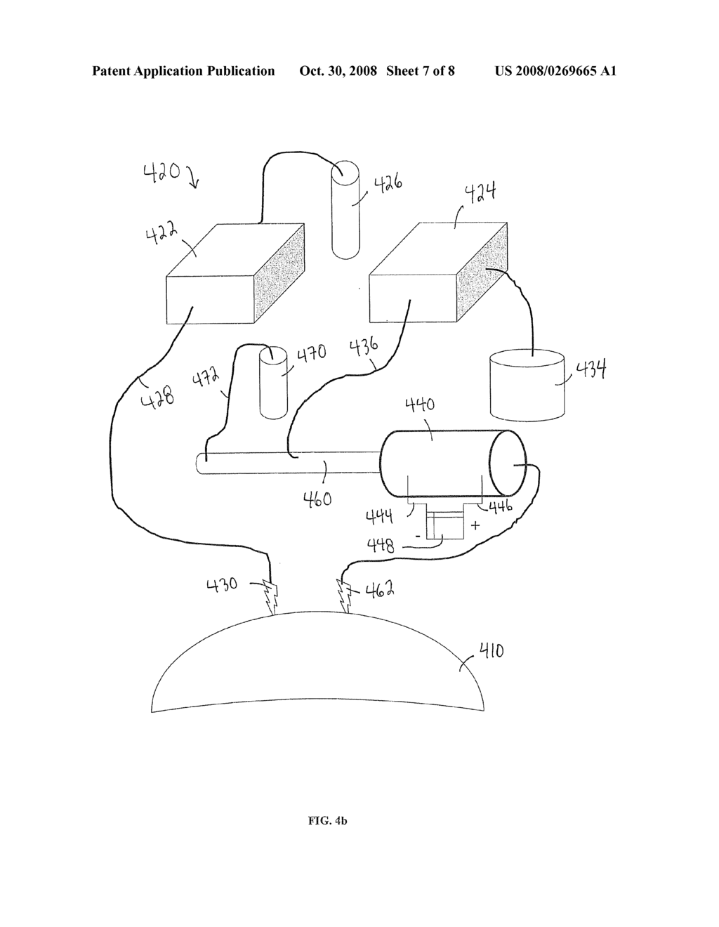 CHEMOTHERAPY DELIVERY DEVICE - diagram, schematic, and image 08