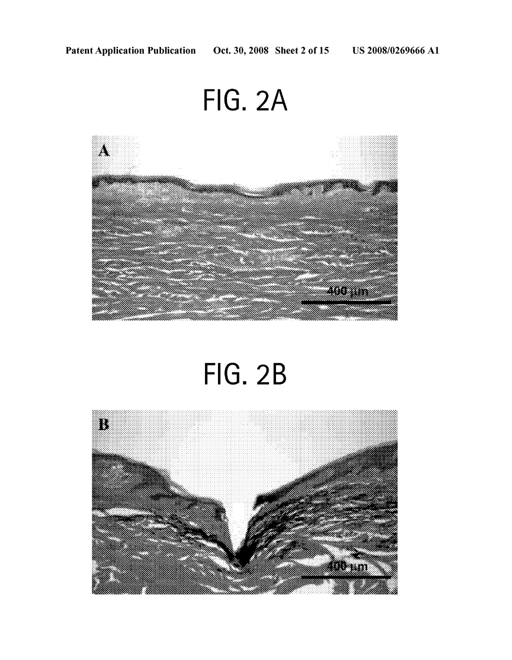 Microneedles and Methods for Microinfusion - diagram, schematic, and image 03