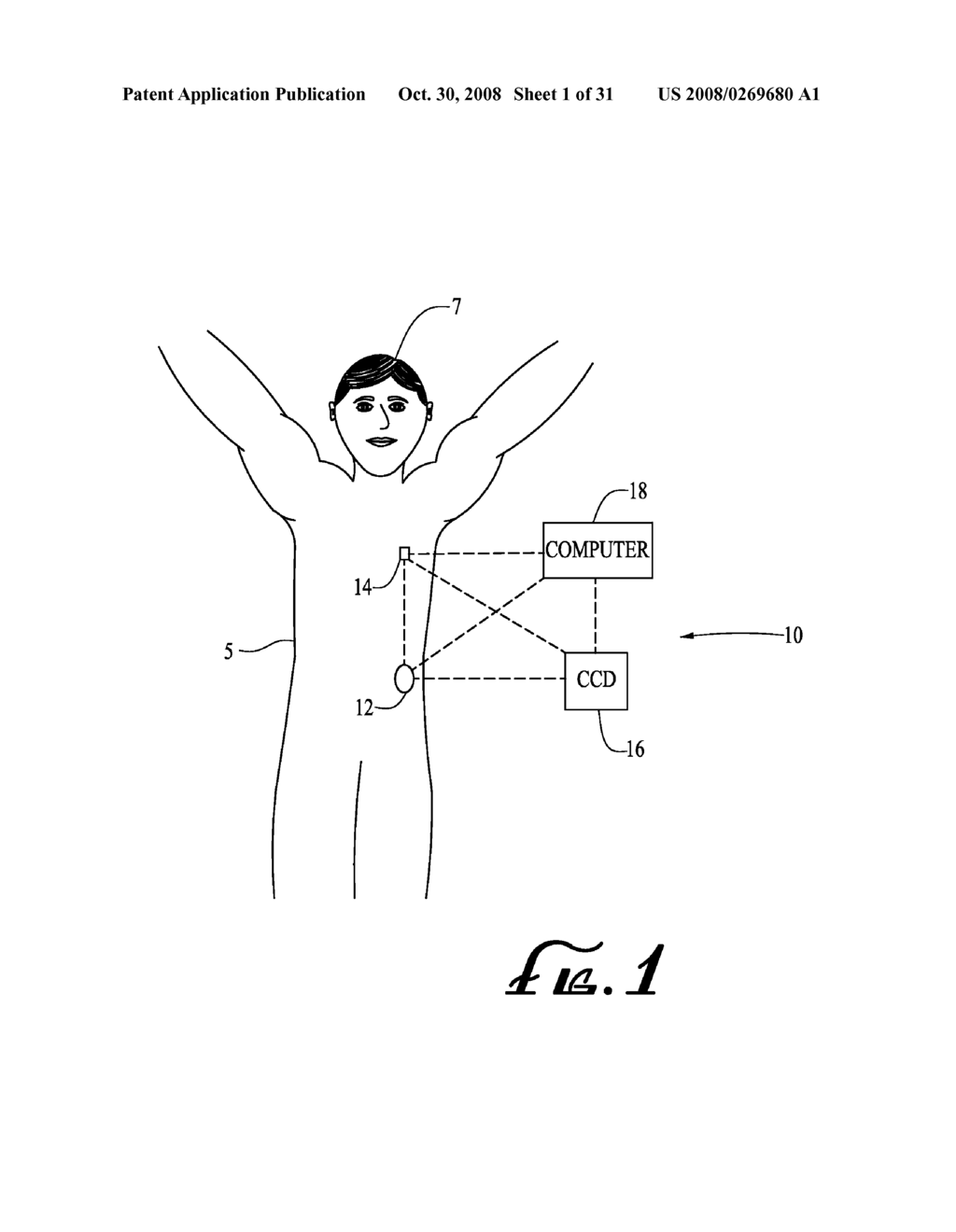 SYSTEMS AND METHODS FOR RESERVOIR FILLING - diagram, schematic, and image 02