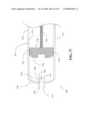 Adhesive Patch Systems and Methods diagram and image