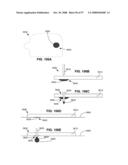 Adhesive Patch Systems and Methods diagram and image