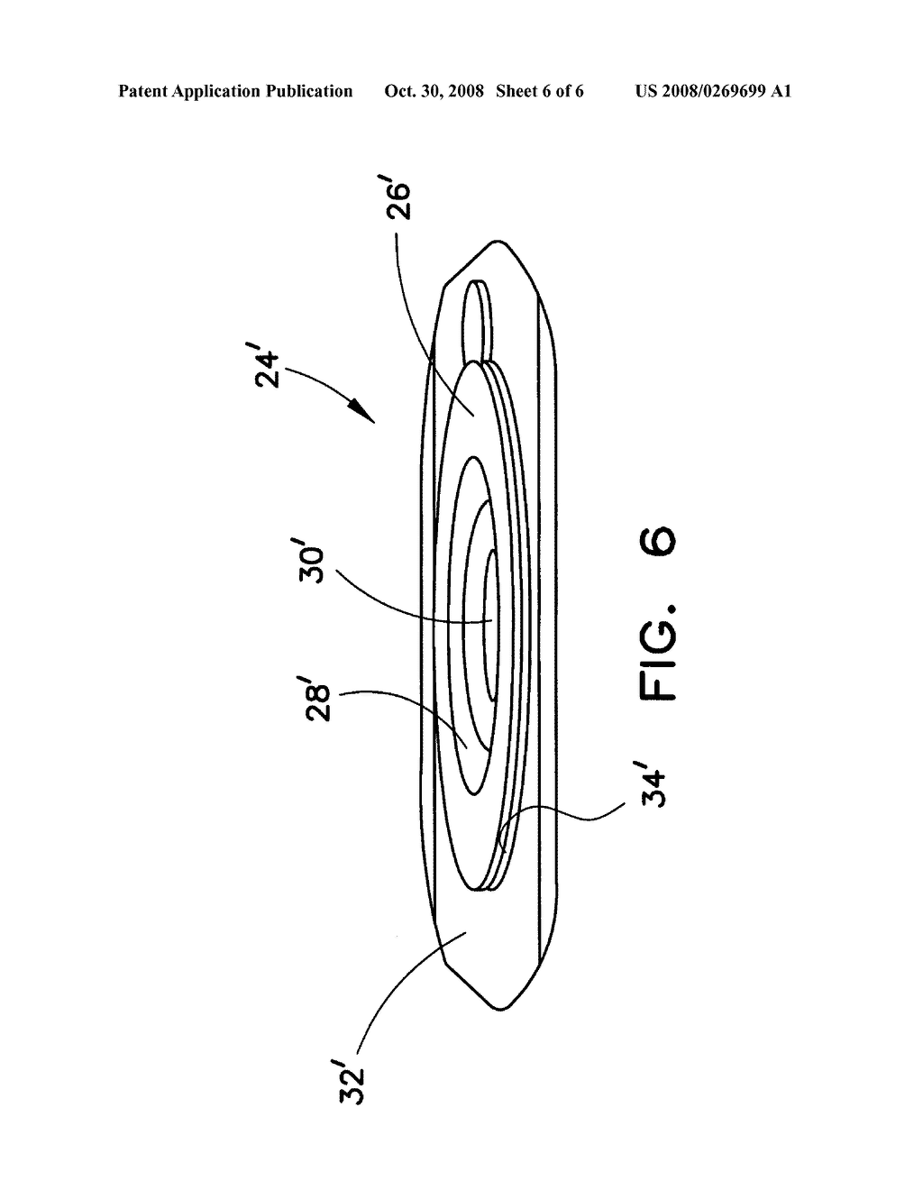 Ostomy pouch - diagram, schematic, and image 07