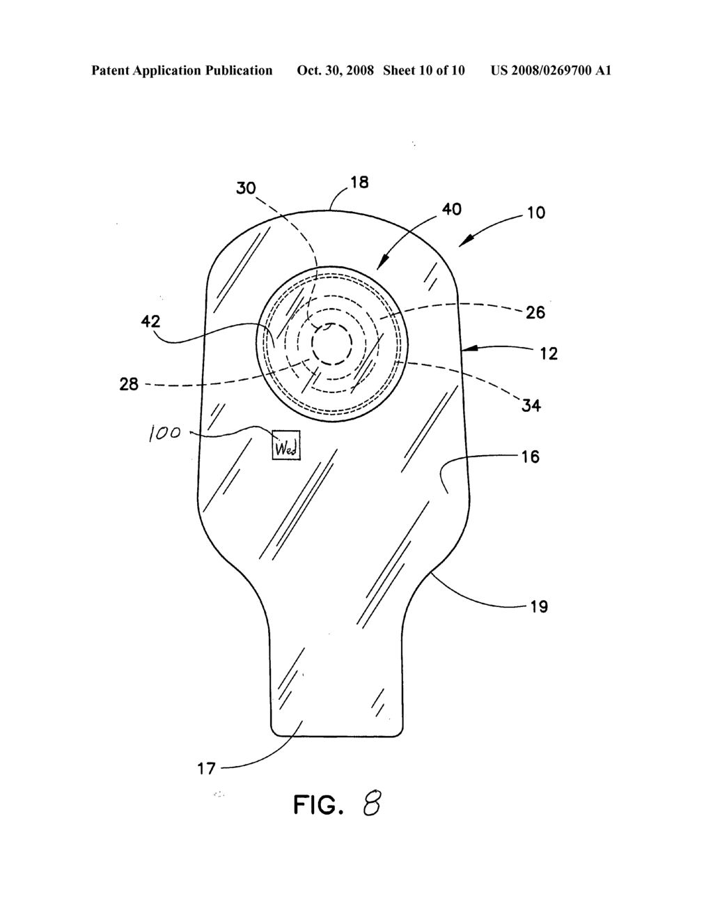 Ostomy pouch - diagram, schematic, and image 11