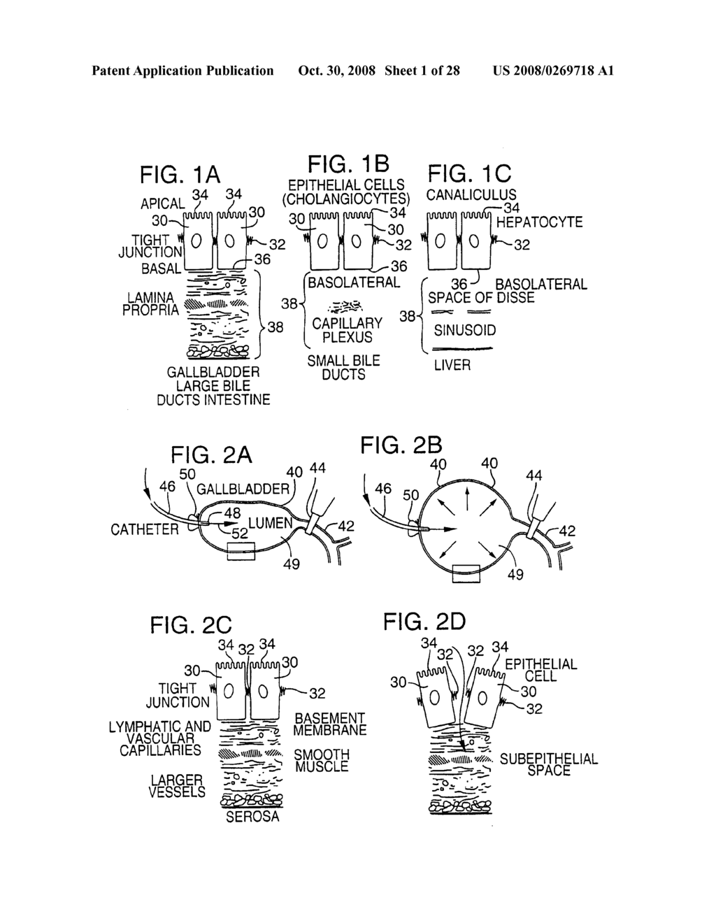 Method for pressure mediated selective delivery of therapeutic substances and cannula - diagram, schematic, and image 02