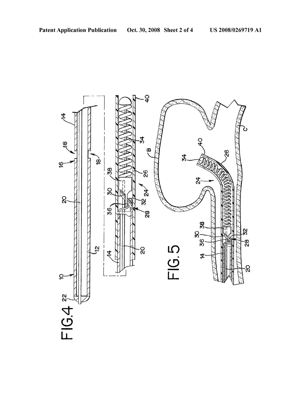 IMPLANTABLE MEDICAL DEVICE DELIVERY SYSTEM WITH A FRANGIBLE PORTION AND METHODS OF MAKING AND USING THE SAME - diagram, schematic, and image 03