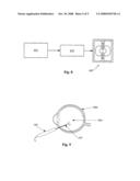 Active Lamp Alignment for Fiber Optic Illuminators diagram and image