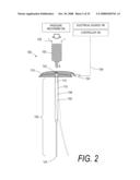 BONE TREATMENT SYSTEMS AND METHODS diagram and image