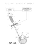 BONE TREATMENT SYSTEMS AND METHODS diagram and image