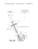 BONE TREATMENT SYSTEMS AND METHODS diagram and image