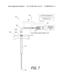 BONE TREATMENT SYSTEMS AND METHODS diagram and image