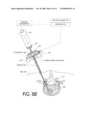 BONE TREATMENT SYSTEMS AND METHODS diagram and image