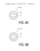 BONE TREATMENT SYSTEMS AND METHODS diagram and image