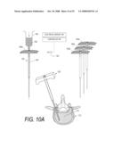 BONE TREATMENT SYSTEMS AND METHODS diagram and image