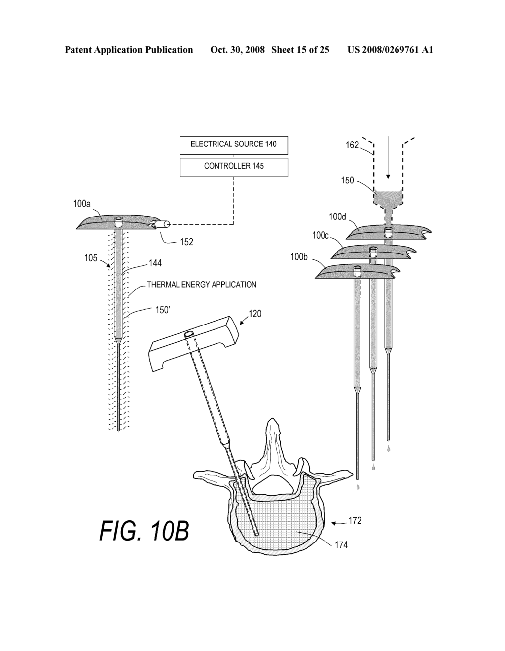 BONE TREATMENT SYSTEMS AND METHODS - diagram, schematic, and image 16