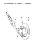 SYSTEM AND METHOD FOR PREPARING A CORNEAL GRAFT diagram and image