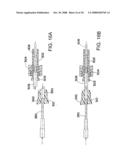 SYSTEM AND METHOD FOR PREPARING A CORNEAL GRAFT diagram and image