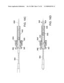 SYSTEM AND METHOD FOR PREPARING A CORNEAL GRAFT diagram and image