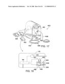 SYSTEM AND METHOD FOR PREPARING A CORNEAL GRAFT diagram and image