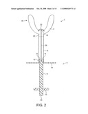 Obstetric Vacuum Extractor diagram and image