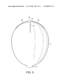 Obstetric Vacuum Extractor diagram and image