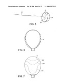 Obstetric Vacuum Extractor diagram and image