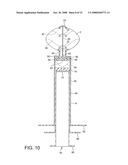 Obstetric Vacuum Extractor diagram and image